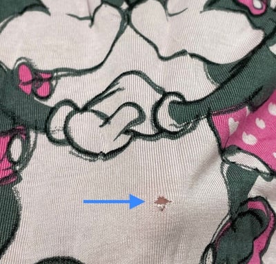 Hole in T-shirt